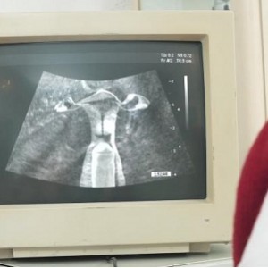 带老婆去医院做B超-B超仪上竟然看到了有东西在CC某处-1V978M