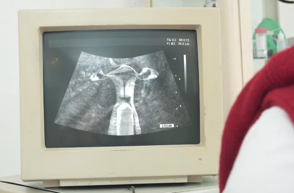 CC神秘地带医院B超室奇葩剧情，颜S惊喜表演！（视频大小/数量）